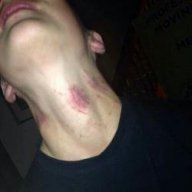 dedsecisback